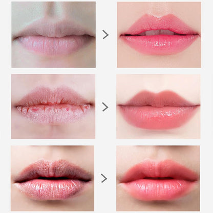 Kit de Reparación Labial