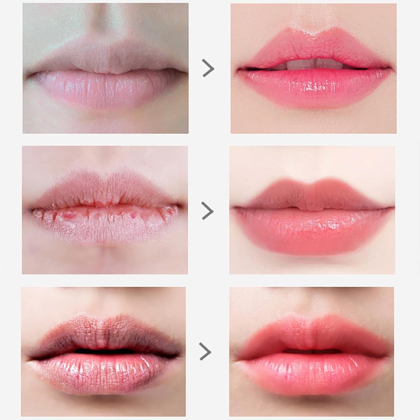 Kit Profesional de Reparación Labial